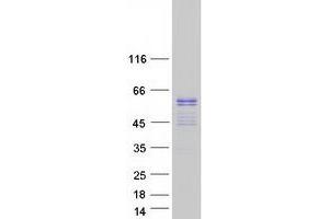 Western Blotting (WB) image for ERG, ETS transcription factor (ERG) (Transcript Variant 2) protein (Myc-DYKDDDDK Tag) (ABIN2720465)