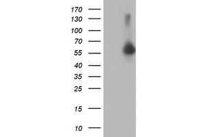Western Blotting (WB) image for anti-V-Akt Murine Thymoma Viral Oncogene Homolog 1 (AKT1) antibody (ABIN1496559) (AKT1 抗体)