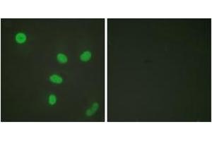 Immunofluorescence analysis of HeLa cells, using Histone H3 (Acetyl-Lys27) Antibody. (Histone 3 抗体  (H3K27ac))