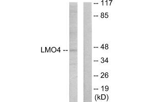 Western blot analysis of extracts from 293 cells, using LMO4 antibody. (LMO4 抗体  (C-Term))