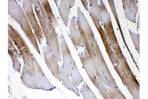 IHC analysis of Connexin 45/GJA7 using anti- Connexin 45/GJA7 antibody .