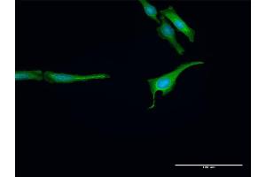 Immunofluorescence of purified MaxPab antibody to RNF14 on HeLa cell. (RNF14 抗体  (AA 1-348))