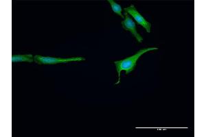 Immunofluorescence of purified MaxPab antibody to RNF14 on HeLa cell.