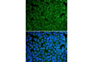 Immunofluorescence analysis of A549 cell using GAD2 antibody. (GAD65 抗体  (AA 401-585))