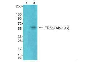 Western blot analysis of extracts from 293 cells (Lane 2), using FRS2 (Ab-196) antiobdy. (FRS2 抗体  (Tyr196))