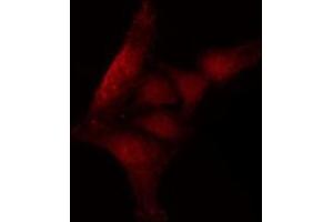 Immunofluorescence (fixed cells) (IF/ICC) image for anti-Nitric Oxide Synthase 2, Inducible (NOS2) (C-Term) antibody (ABIN6262590)