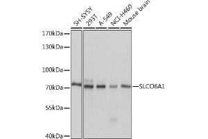 Western blot analysis of extracts of various cell lines, using SLCO6 Rabbit pAb (4963) at 1:1000 dilution.