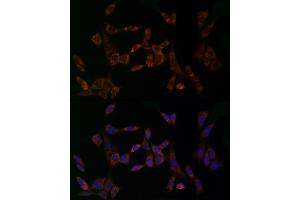 Immunofluorescence analysis of NIH/3T3 cells using MDK Rabbit pAb (ABIN3020790, ABIN3020791, ABIN3020792 and ABIN6213725) at dilution of 1:25 (40x lens). (Midkine 抗体  (AA 21-143))