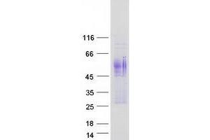 Western Blotting (WB) image for anthrax Toxin Receptor 1 (ANTXR1) (Transcript Variant 2) protein (Myc-DYKDDDDK Tag) (ABIN2714756)