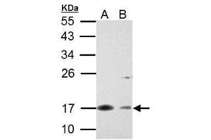 WB Image Survivin antibody detects Survivin protein by Western blot analysis. (Survivin 抗体  (C-Term))