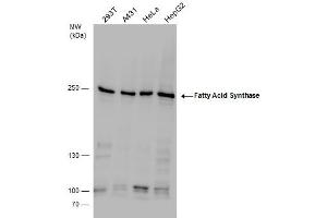 WB Image Fatty Acid Synthase antibody detects Fatty Acid Synthase protein by western blot analysis. (Fatty Acid Synthase 抗体  (N-Term))