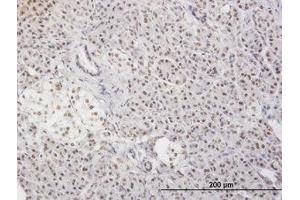 Image no. 3 for anti-Myeloid Leukemia Factor 2 (MLF2) (AA 1-249) antibody (ABIN599027) (MLF2 抗体  (AA 1-249))