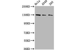 Western Blot Positive WB detected in: Hela whole cell lysate, A549 whole cell lysate, 293 whole cell lysate All lanes: SEMA6D antibody at 3 μg/mL Secondary Goat polyclonal to rabbit IgG at 1/50000 dilution Predicted band size: 120, 114, 112, 116, 118, 55, 68 kDa Observed band size: 130 kDa (SEMA6D 抗体  (AA 913-1068))
