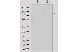 anti-Membrane-Bound Transcription Factor Peptidase, Site 1 (MBTPS1) (Internal Region) antibody