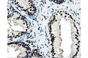 Immunohistochemical staining of paraffin-embedded colon tissue using anti-PSMC3mouse monoclonal antibody. (PSMC3 抗体)