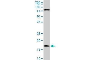 Western Blotting (WB) image for anti-Cofilin 1 (CFL1) (AA 1-167) antibody (ABIN598606) (Cofilin 抗体  (AA 1-167))