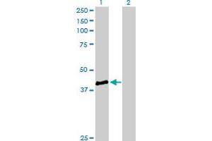 Western Blot analysis of STBD1 expression in transfected 293T cell line by STBD1 MaxPab polyclonal antibody. (STBD1 抗体  (AA 1-358))