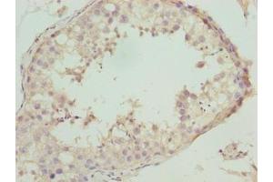 Immunohistochemistry of paraffin-embedded human testis tissue using ABIN7161250 at dilution of 1:100 (NBPF3 抗体  (AA 1-252))
