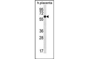 Western blot analysis of LCCI1 Antibody (Center) in human placenta tissue lysates (35ug/lane). (GLCCI1 抗体  (Middle Region))