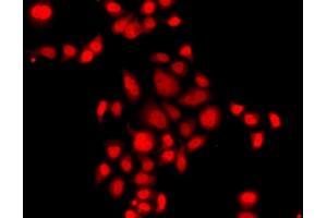 Immunofluorescence analysis of  cells using MLF1 antibody (ABIN6128238, ABIN6143875, ABIN6143877 and ABIN6224035). (MLF1 抗体  (AA 1-268))