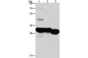 Western Blot analysis of Mouse liver and kidney tissue, Human fetal liver tissue using KHK Polyclonal Antibody at dilution of 1:1250 (Ketohexokinase 抗体)