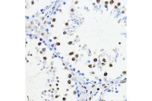 Immunohistochemistry of paraffin-embedded mouse testis using ZEB1 antibody (ABIN6129933, ABIN6150422, ABIN6150423 and ABIN6221237) at dilution of 1:200 (40x lens).