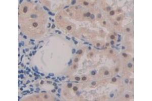IHC-P analysis of Human Tissue, with DAB staining. (NKRF 抗体  (AA 1-296))