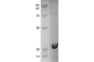 Validation with Western Blot (PPP3R1 Protein (His tag))