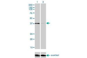 Western blot analysis of RNF2 over-expressed 293 cell line, cotransfected with RNF2 Validated Chimera RNAi (Lane 2) or non-transfected control (Lane 1). (RNF2 抗体  (AA 192-290))