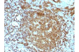 Formalin-fixed, paraffin-embedded human Tonsil stained with CD45RA Mouse Monoclonal Antibody (PTPRC/818). (CD45 抗体)