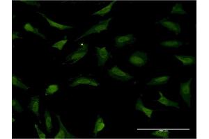 Immunofluorescence of monoclonal antibody to RNF2 on HeLa cell. (RNF2 抗体  (AA 192-290))