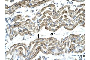 C13ORF8 antibody was used for immunohistochemistry at a concentration of 4-8 ug/ml to stain Skeletal muscle cells (arrows] in Human Muscle. (ZNF828 抗体  (Middle Region))