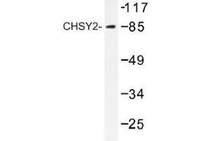 Image no. 1 for anti-Chondroitin Sulfate Synthase 3 (CHSY3) antibody (ABIN317828) (CHSY3 抗体)