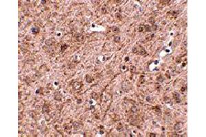 Immunohistochemistry of LASS6 in mouse brain tissue with LASS6 polyclonal antibody  at 2. (CERS6 抗体  (N-Term))