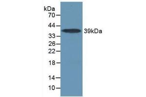 Detection of Recombinant IL17RA, Mouse using Polyclonal Antibody to Interleukin 17 Receptor A (IL17RA) (IL17RA 抗体  (AA 590-848))