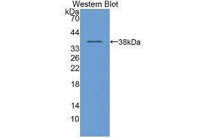 Western blot analysis of the recombinant protein. (TNP1 抗体  (AA 3-53))