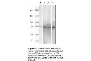 Image no. 2 for anti-RAB25, Member RAS Oncogene Family (RAB25) antibody (ABIN207613) (RAB25 抗体)