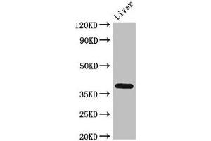 Western Blot Positive WB detected in: Rat liver tissue All lanes: ETV7 antibody at 3 μg/mL Secondary Goat polyclonal to rabbit IgG at 1/50000 dilution Predicted band size: 39, 33, 31, 37, 30, 23 kDa Observed band size: 39 kDa (ETV7 抗体  (AA 134-218))