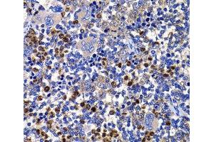 Immunohistochemistry of paraffin-embedded Rat spleen using STAMBP Polyclonal Antibody at dilution of 1:100 (40x lens). (STAMBP 抗体)
