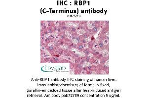 Image no. 2 for anti-Retinol Binding Protein 1, Cellular (RBP1) (C-Term) antibody (ABIN1738770) (RBP1 抗体  (C-Term))