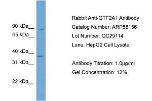 WB Suggested Anti-GTF2A1  Antibody Titration: 0. (GTF2A1 抗体  (Middle Region))
