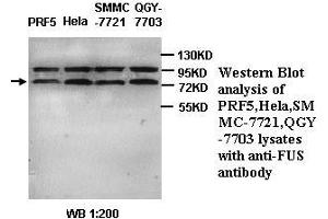 Image no. 1 for anti-Fused in Sarcoma (FUS) (C-Term) antibody (ABIN791042) (FUS 抗体  (C-Term))