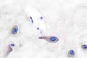 Immunohistochemistry (IHC)analyzes of MARCKS antibody in paraffin-embedded human brain tissue. (MARCKS 抗体)