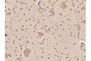Immunohistochemistry (Paraffin-embedded Sections) (IHC (p)) image for anti-SRY (Sex Determining Region Y)-Box 4 (SOX4) (AA 54-103) antibody (ABIN1387237)