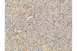ABIN7096249 and ABIN7100311 at 1/100 staining mouse liver tissue by IHC-P.