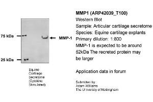 Sample Type: Equine Cartilage ExplantsPrimary Dilution: 1:800Secondary Antibody: Bio-Rad 170-5046 Secondary Dilution: 1:100,000Image Submitted By: Adam WilliamsUniversity of Nottingham