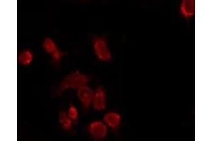 ABIN6277380 staining Hela by IF/ICC. (KISS1R 抗体  (C-Term))