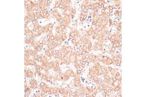 Immunohistochemistry of paraffin-embedded human liver using ABCB7 antibody (ABIN6291732) at dilution of 1:100 (40x lens). (ABCB7 抗体)