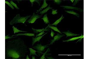 Immunofluorescence (IF) image for anti-RAB31, Member RAS Oncogene Family (RAB31) (AA 1-195) antibody (ABIN949027)