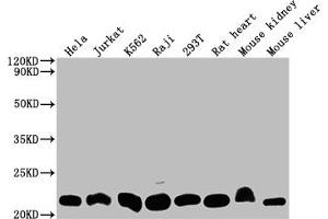 Western Blot Positive WB detected in: Hela whole cell lysate, Jurkat whole cell lysate, K562 whole cell lysate, Raji whole cell lysate, 293T whole cell lysate, Rat heart tissue, Mouse kidney tissue, Mouse liver tissue All lanes: DHFR antibody at 1:2000 Secondary Goat polyclonal to rabbit IgG at 1/50000 dilution Predicted band size: 22, 16 kDa Observed band size: 22 kDa (Recombinant Dihydrofolate Reductase 抗体)